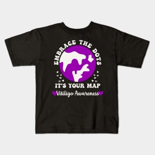 Vitiligo Awareness Embrace the Dots Vitiligo Acceptance Kids T-Shirt